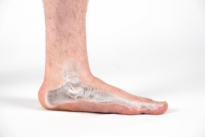 When to See a Podiatrist for Flat Feet