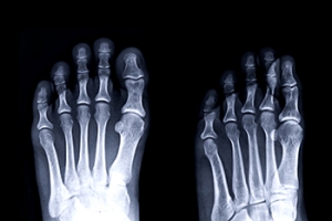 The Foot as the Foundation for Balance