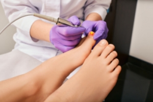 Pros and Cons of Laser Treatment for Fungal Toenails