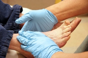 Managing Diabetic Foot Issues